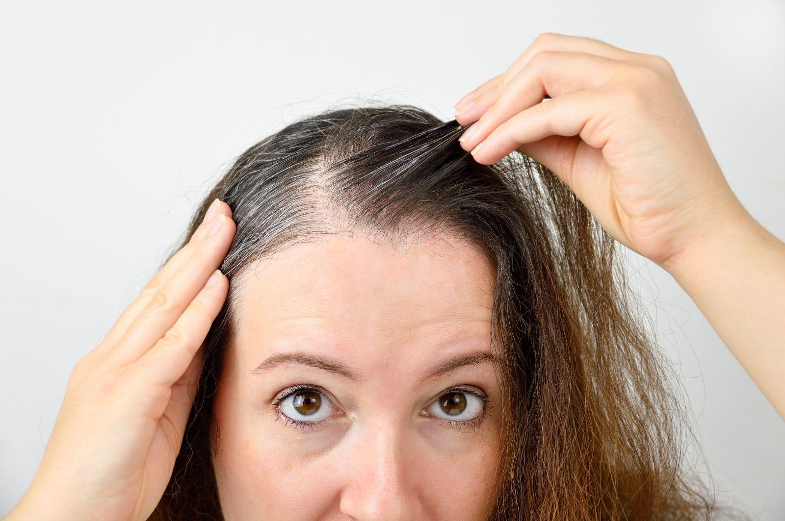 J'ai mes premiers cheveux blancs : paniquer, assumer ou colorer ? Amélie vous répond honnêtement
